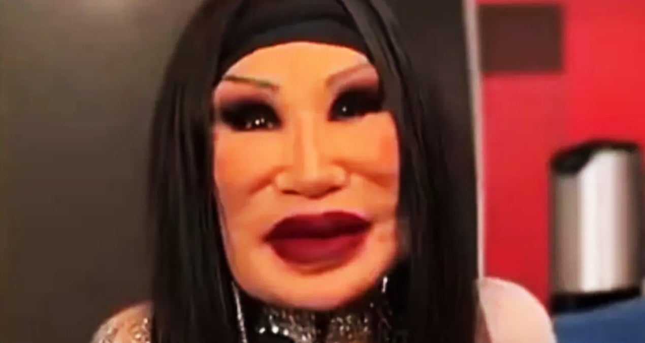 Ünlü oyuncunun yüzüne yemek yağı enjekte edildi! Hayatı cehenneme döndü